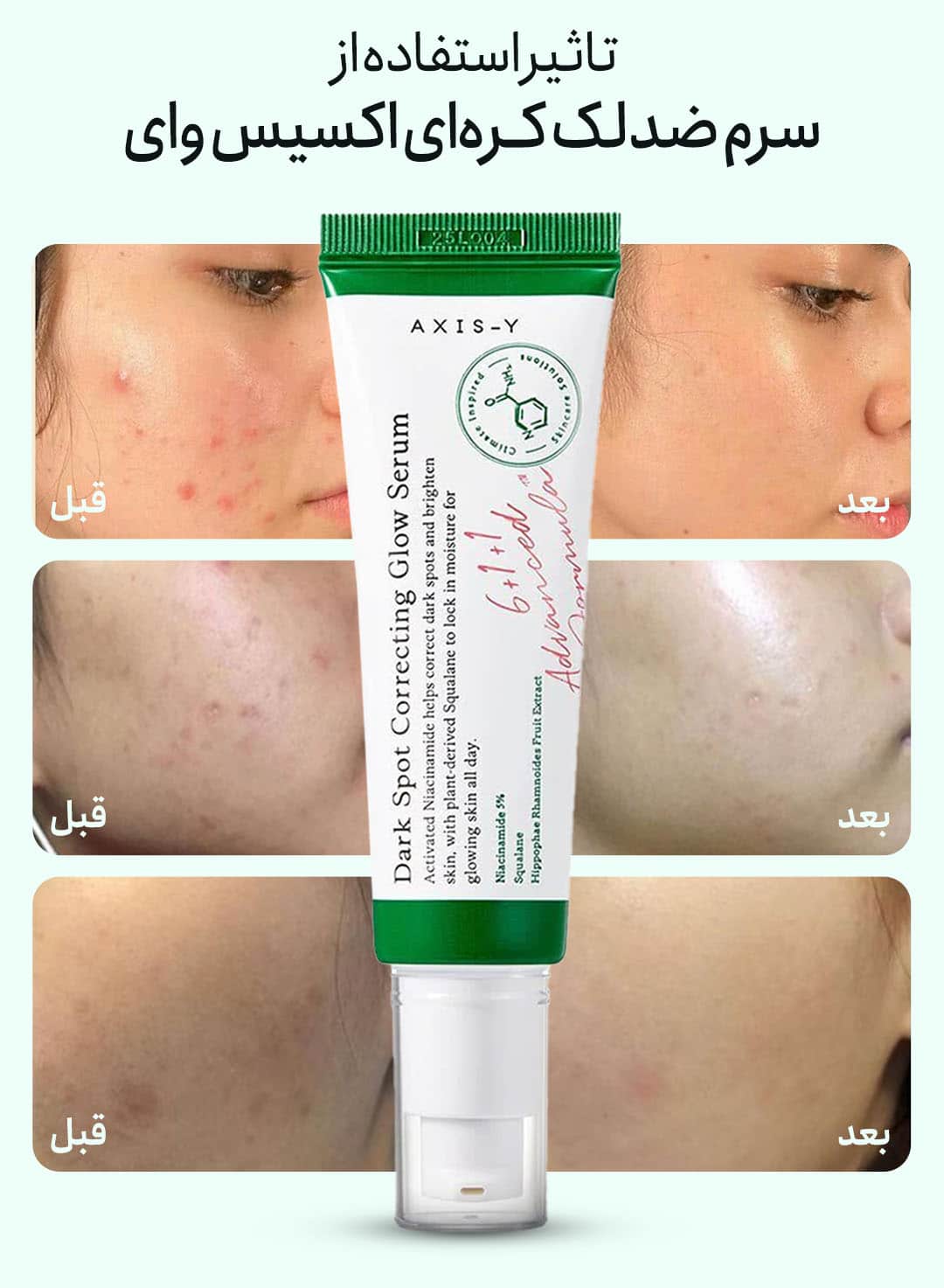 سرم ضد لک اکسیس وای نظرات - خرید سرم ضد لک اکسیس وای اصل