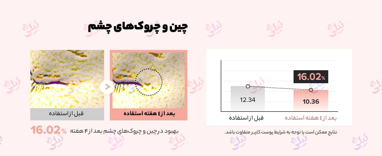 سرم دور چشم بیوتی آف جوسان