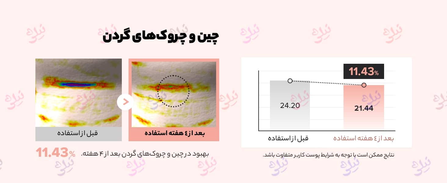 سرم دور چشم بیوتی او جوسان جینسنگ و رتینال [ضد چروک و روشن کننده]