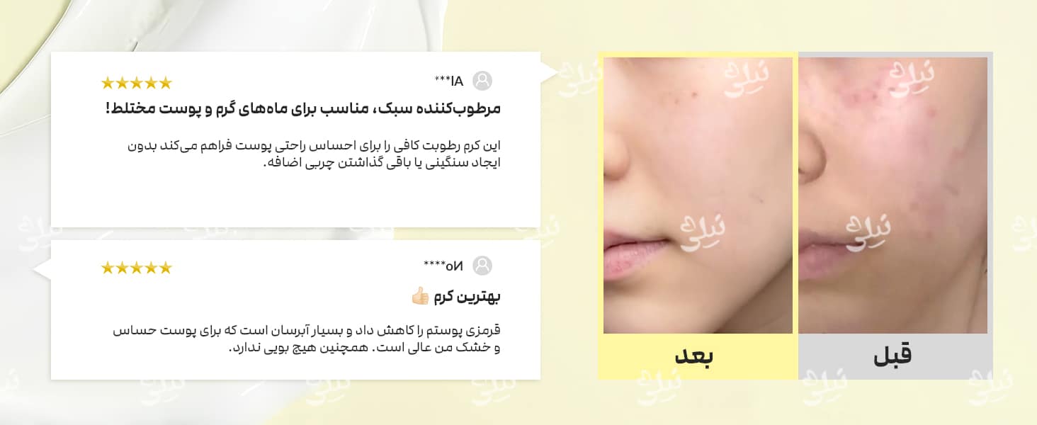 نظرات کاربران درباره کرم ترمیم کننده دکتر آلتیا 345