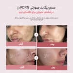 نتایج استفاده از سرم صورتی مدی کیوب