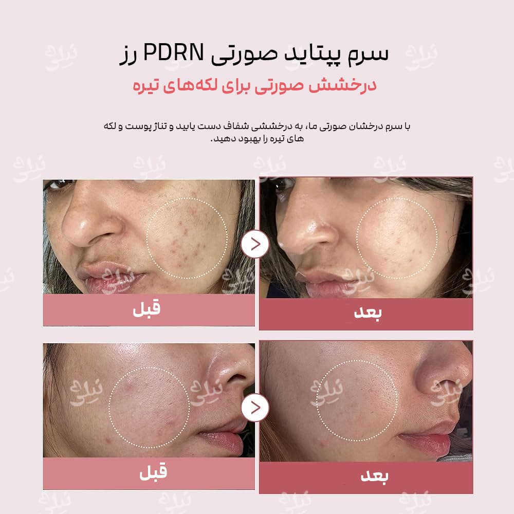 نتایج استفاده از سرم صورتی مدی کیوب