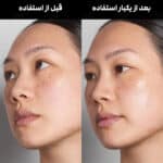 قبل و بعد استفاده سرم آبرسان اینکی لیست