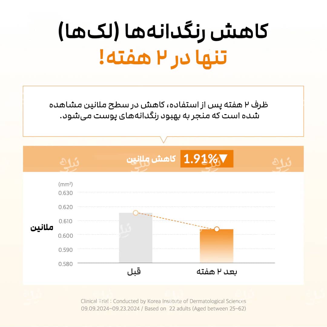 کاهش لک و روشن کننده صورت تنها پس از 2 هفته استفاده از سرم ویتامین سی دکتر آلتیا