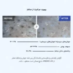 اثرات استفاده از ماسک مدی کیوب