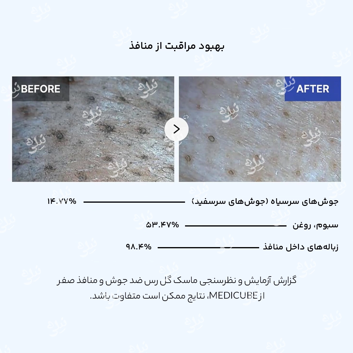 اثرات استفاده از ماسک مدی کیوب