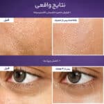 نتایج واقعی استفاده از سرم جوانساز شماره 9 نامبوزین