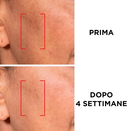 کرم روز ضدچروک Revitalift Laser SPF25 لورآل