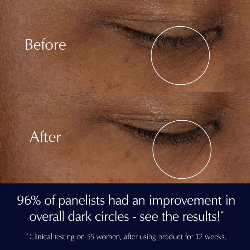 کرم دور چشم Advanced Night Repair استی لادر؛ روشن‌کننده و جوانساز